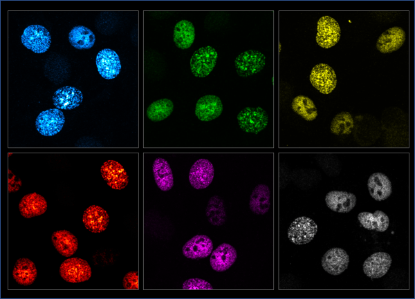 MCM proteiny v buněčném jádře nabarvené pomocí různých fluorescenčních barviček (tzv. Halo ligandů). Zdroj: archiv Hany Polášek-Sedláčkové