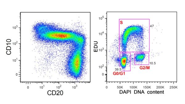 Ukázky cytometrických výsledků. Vlevo je vývoj B-lymfocytů v kostní dřeni detekovaný podle exprese znaků CD10 a CD20. Vpravo je zobrazena analýza proliferace (množení) bílých krvinek detekovaná podle množství DNA. 