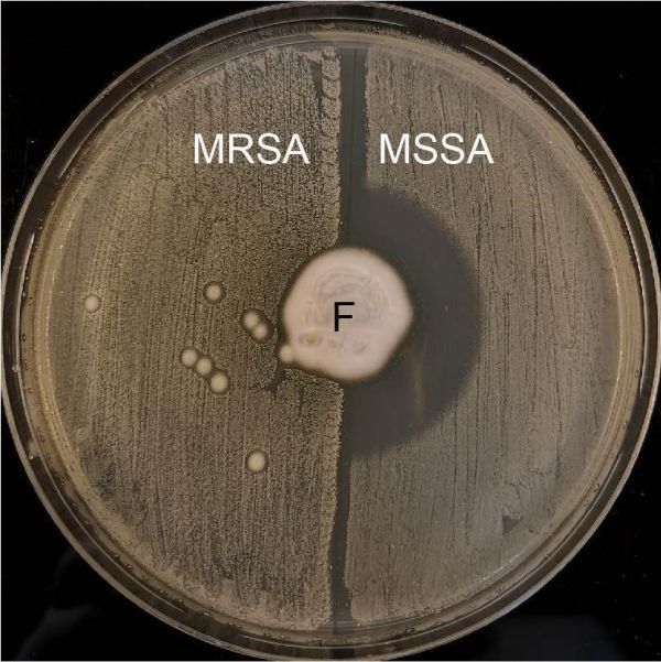 Petriho miska s agarem, na kterém roste houba (F) produkující antibiotikum. Na levé polovině misky rostou bakterie rezistentní na antibiotikum (MRSA), na pravé polovině misky jsou citlivé bakterie (MSSA) – antibiotikum produkované houbou je zabíjí a vytváří čistý půlkruh vpravo uprostřed. 